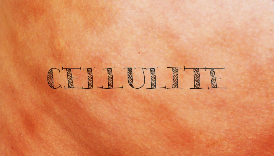 Cellulite,cellulite reduction in Mumbai