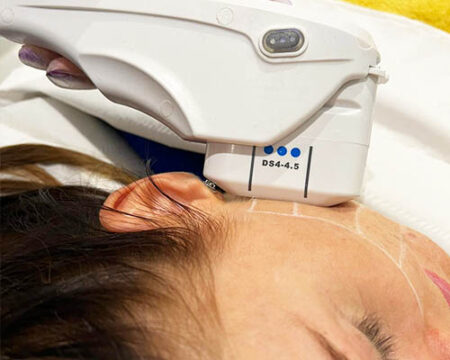 HIFU Facelift - Hifu Facelift & Body Tightening