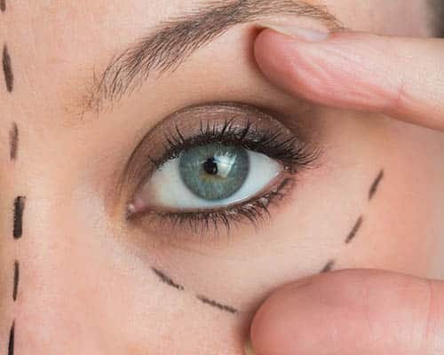 Non-Surgical Lift