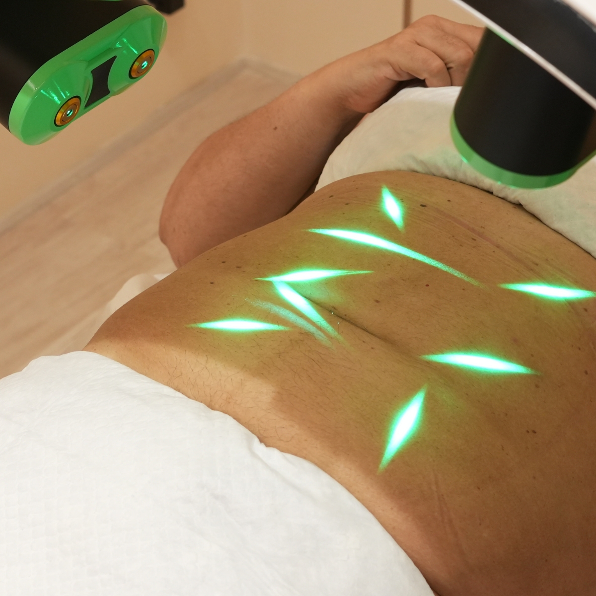 body tightening in Mumbai, non-surgical body tightening in Mumbai, emerald laser treatment in Mumbai, radio frequency body tightening in Mumbai, best clinic for body tightening in Mumbai - Pic